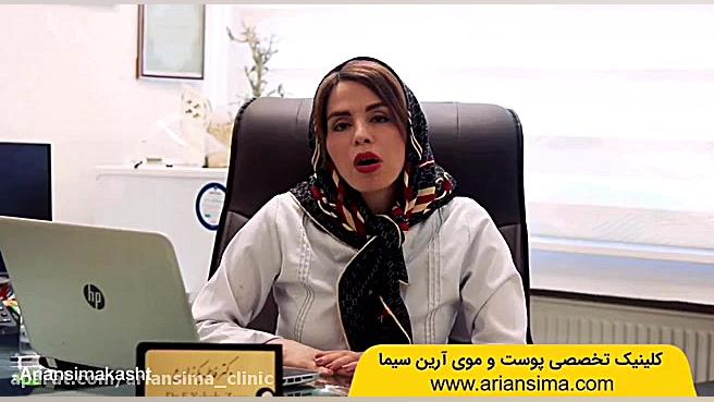 کاشت موی طبیعی | هزینه کاشت مو | کلینیک آرین سیما بیماری منیر