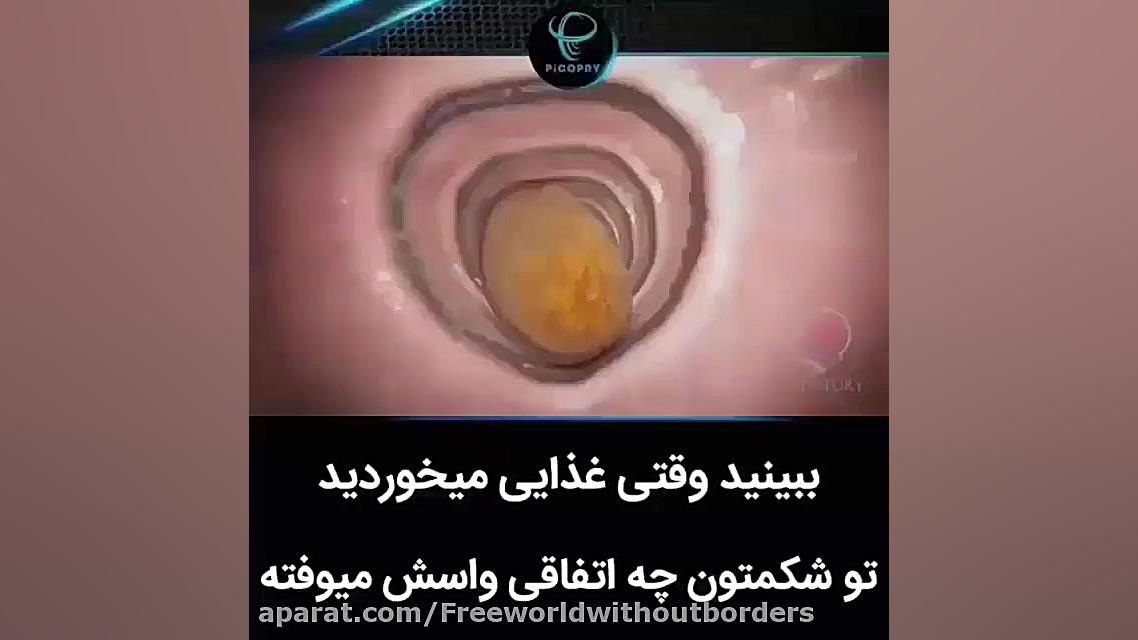 دستگاه گوارش انسان جرمگیری
