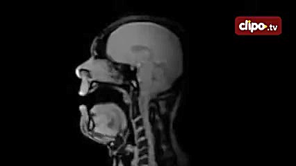 کلیپ با حال ازموسیقی دان مشهور رادیولوژی حنجره ریچارد واگنر(Richard Wagner) ترمیم سوختگی