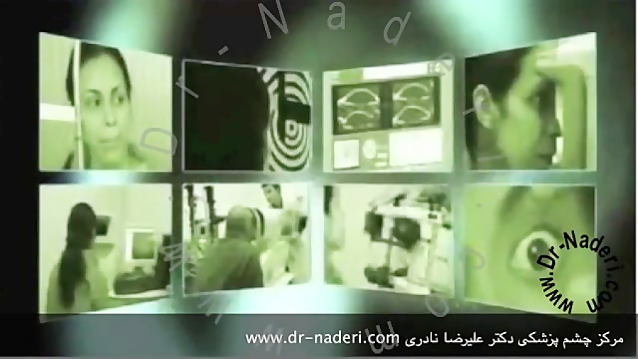 مروری کلی بر قوز قرنیه -سایت چشم پزشکی دکتر نادری مرکز چشم پزشکی دکتر علیرضا نادری www.dr-naderi.com