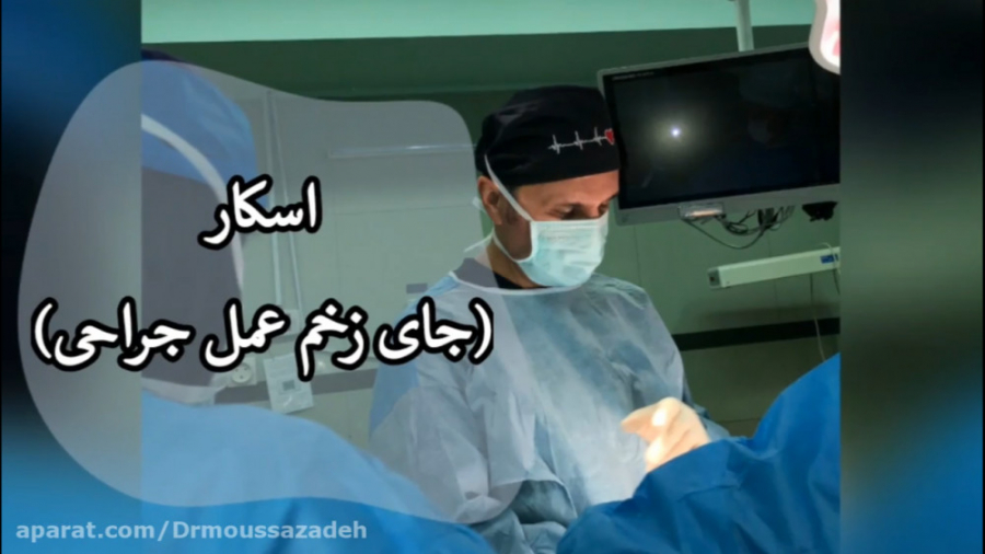 اسکار (جای زخم عمل جراحی) ترمیم زیبایی دندان
