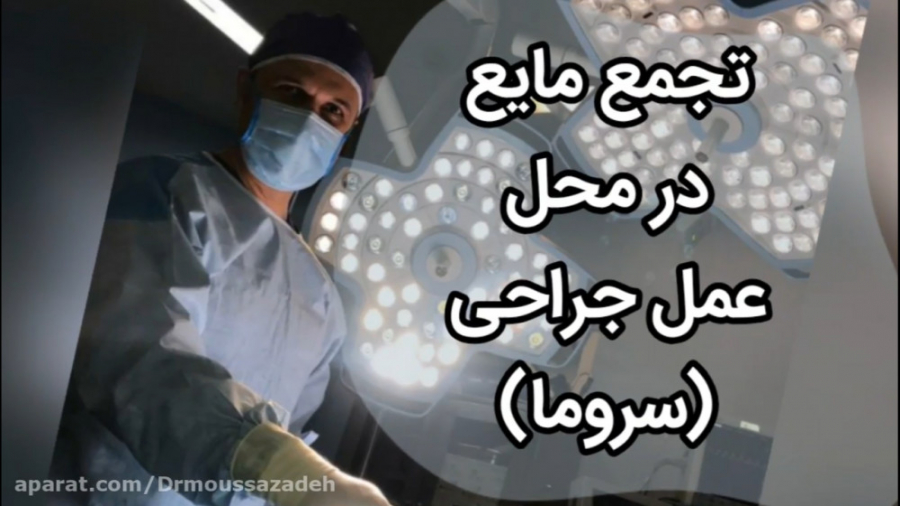 تجمع مایع در محل عمل پستان برداشتن زگیل