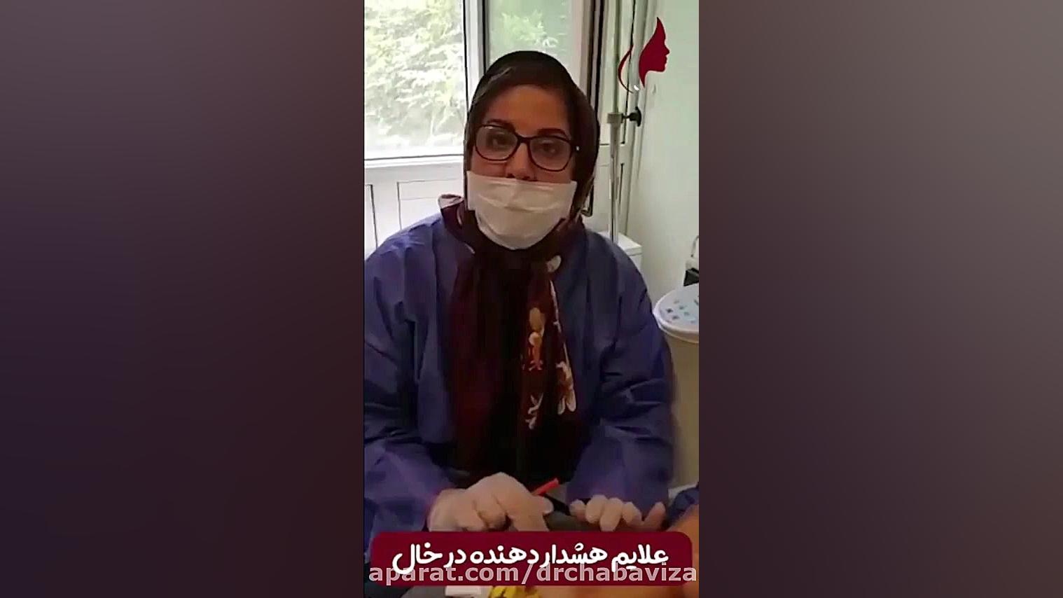 علائم هشدار دهنده خال دکتر صفیه چعباوی زاده