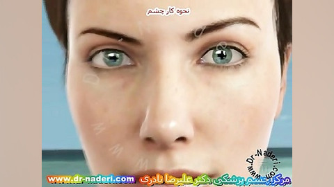 نحوه کار کره چشم-مرکز چشم پزشکی دکتر علیرضا نادری مرکز چشم پزشکی دکتر علیرضا نادری www.dr-naderi.com