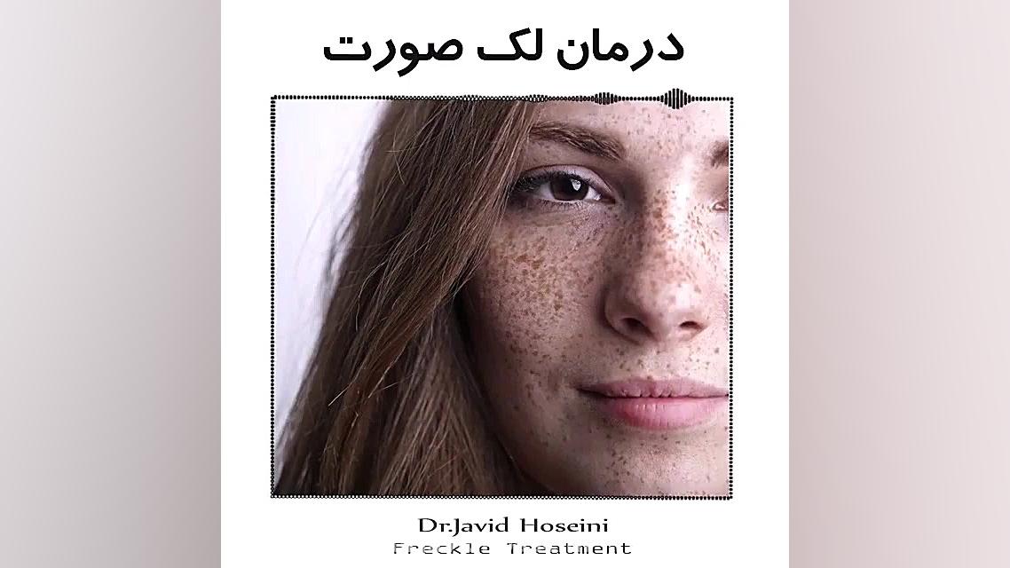 درمان لک صورت ماموپلاستی