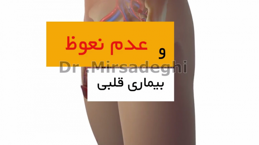مشکلات قلبی و عروقی و عدم نعوظ - دکتر میر صادقی زیبایی پوست