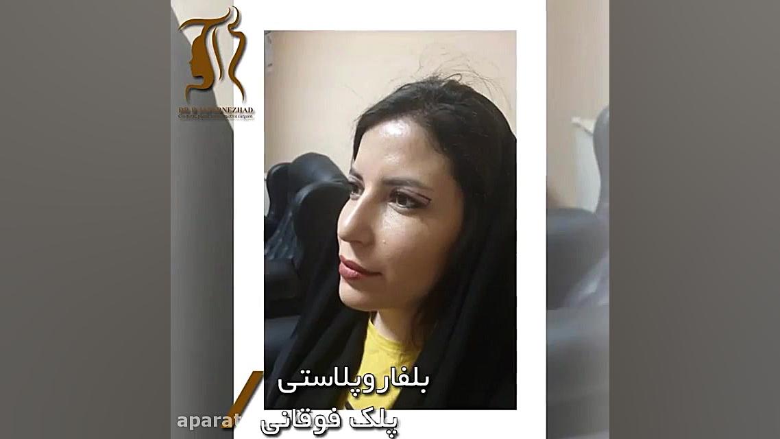 فیلم بدون سانسور جراحی پلک دکتر بابک جعفرنژاد