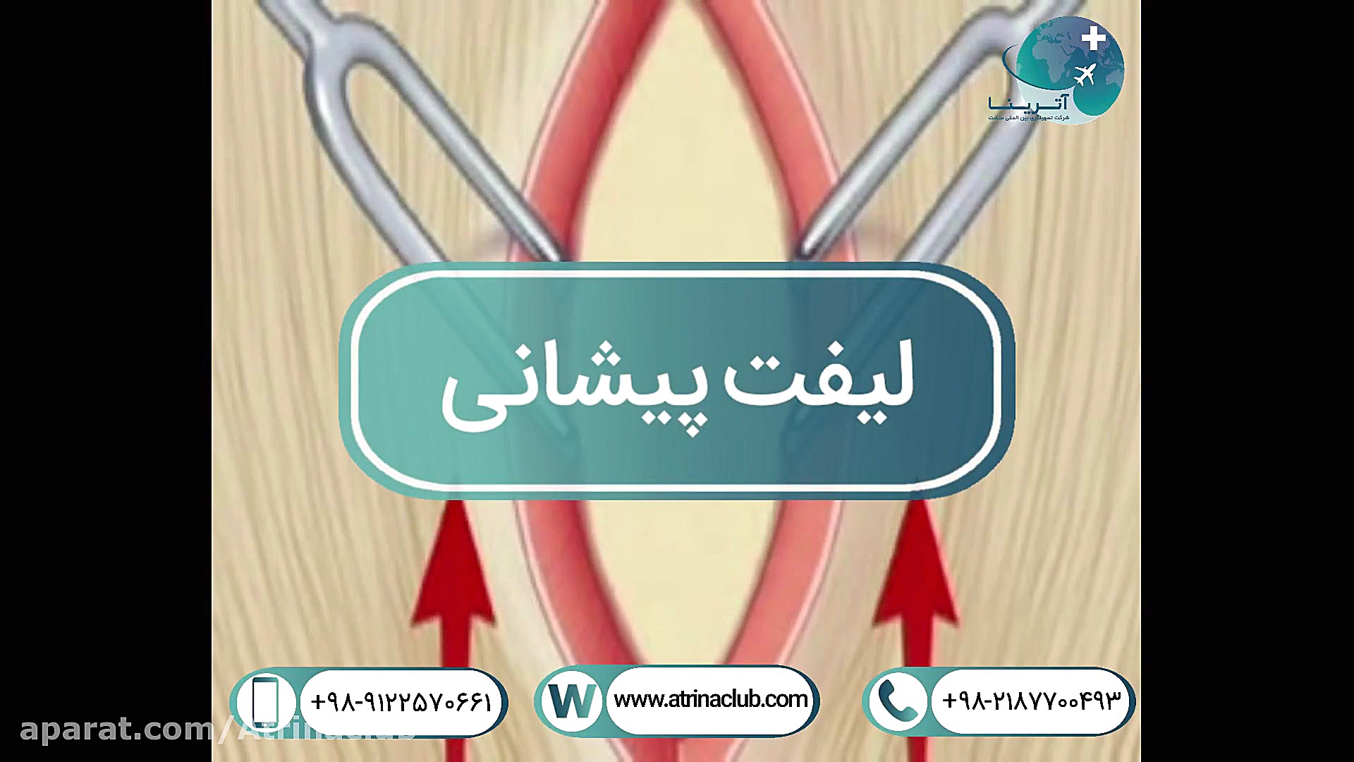 لیفت پیشانی اینسایزینگ