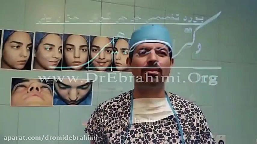 جراحی زیبایی بینی پهن و قوزدار توسط دکتر امید ابراهیمی بهترین جراح بینی دکتر امید ابراهیمی