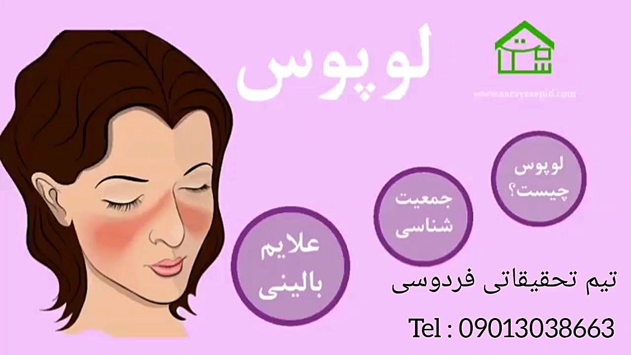 لوپوس چیست و چگونه درمان می شود عمل زیبایی