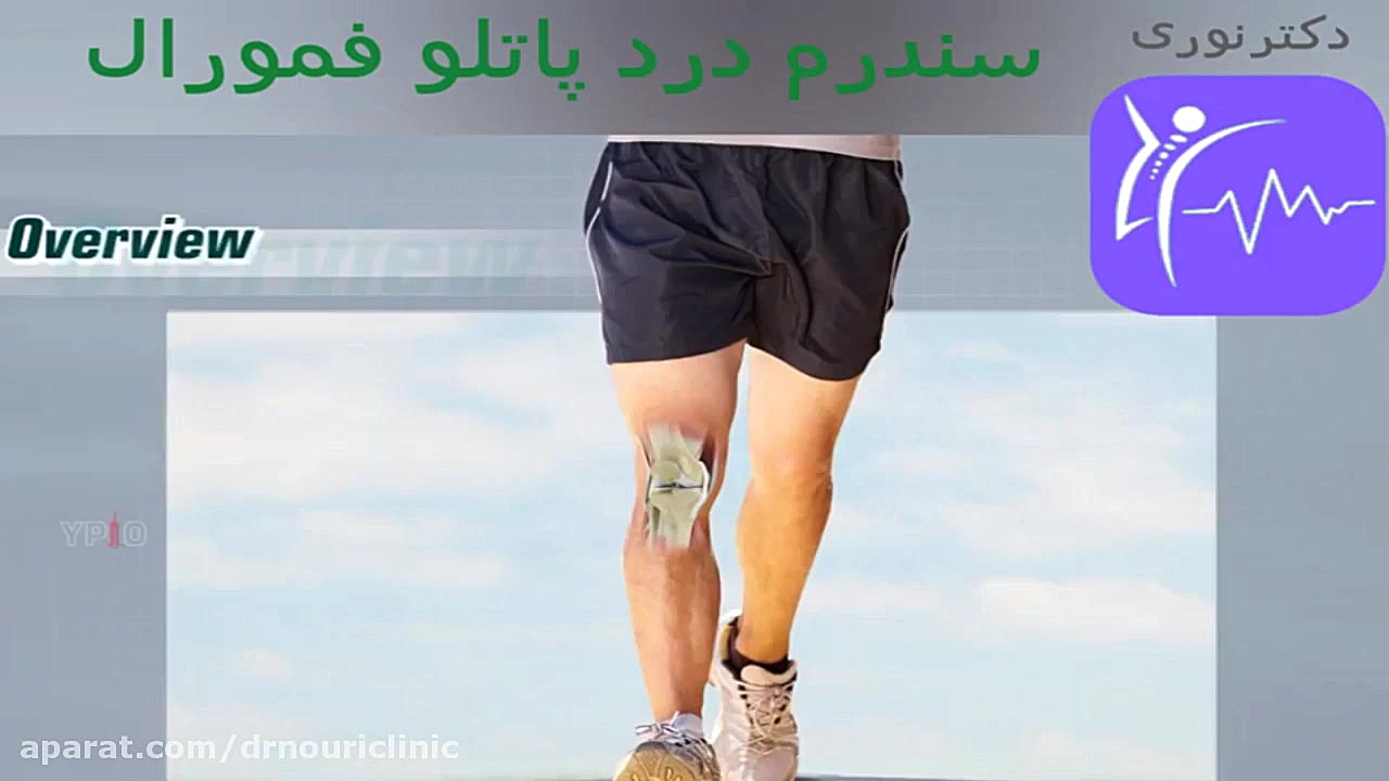 نرمی کشکک زانو یا سندرم درد پاتلو فمورال دکتراسماعیل نوری