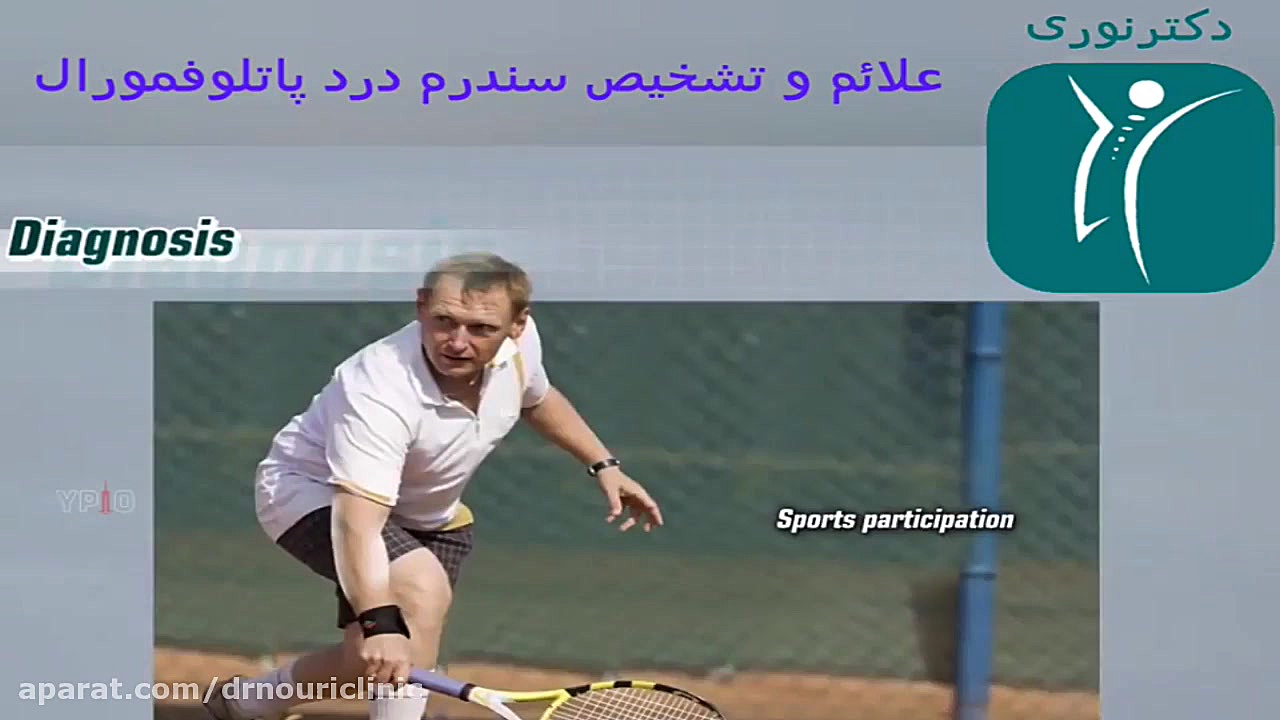 علائم سندرم درد پاتلوفمورال دکتراسماعیل نوری