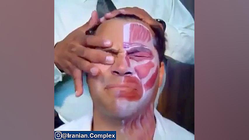 تمرينات مناسب جهت بازتواني عضلات صورت در كساني كه دچار عارضه فلج بلز ‌هستند ترقه پران