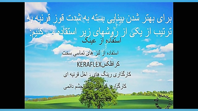 روشهای نوین درمان قوز قرنیه - مرکز چشم پزشکی دکتر نادری مرکز چشم پزشکی دکتر علیرضا نادری www.dr-naderi.com