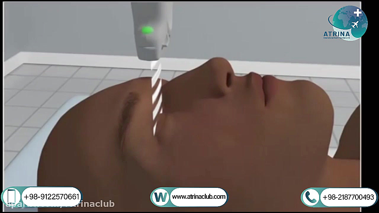 B scan one eye in atrina پیلینگ شیمیایی