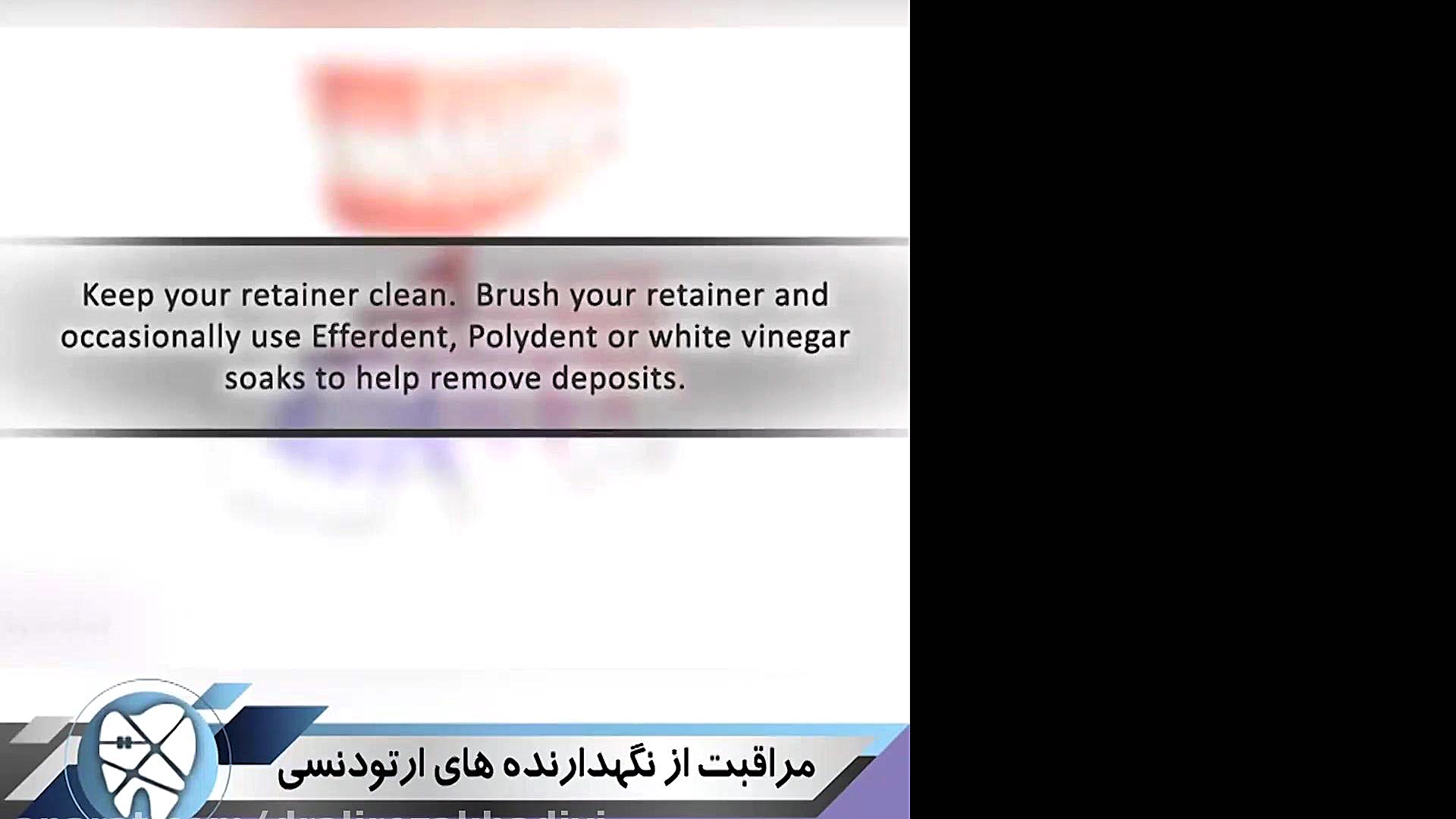 مراقبت از نگهدارنده های ارتودنسی.متخصص ارتودنسی تهران.دکتر علیرضا خدیوی دکتر علیرضا خدیوی
