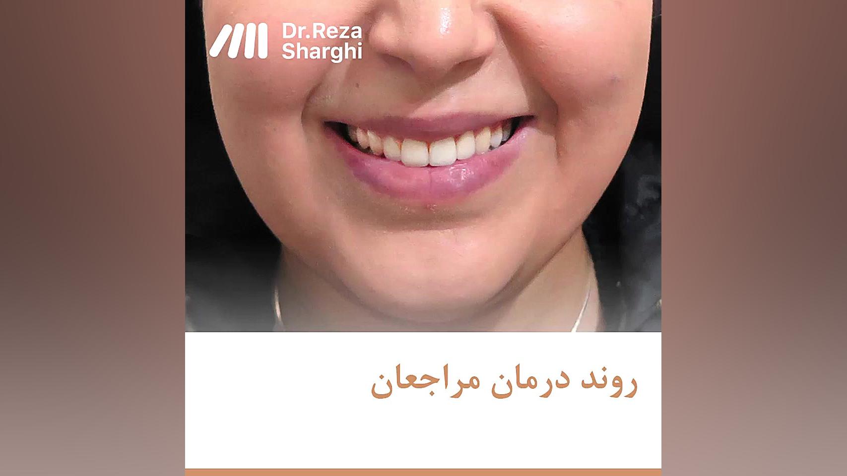 روند درمان ارتودنسی - خانم ن دکتر رضا شرقی