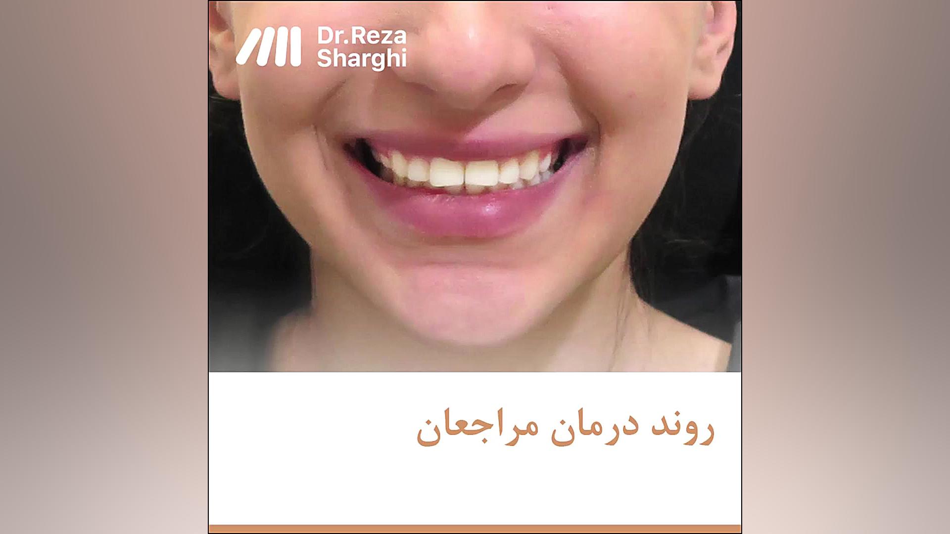 روند درمان ارتودنسی - خانم الف دکتر رضا شرقی