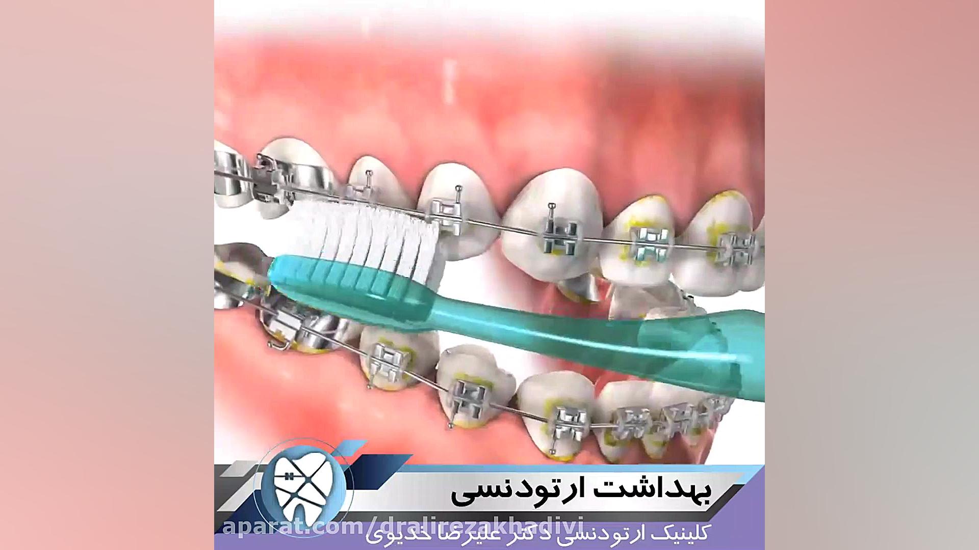 بهداشت ارتودنسی.متخصص ارتودنسی تهران.دکترعلیرضاخدیوی دکتر علیرضا خدیوی