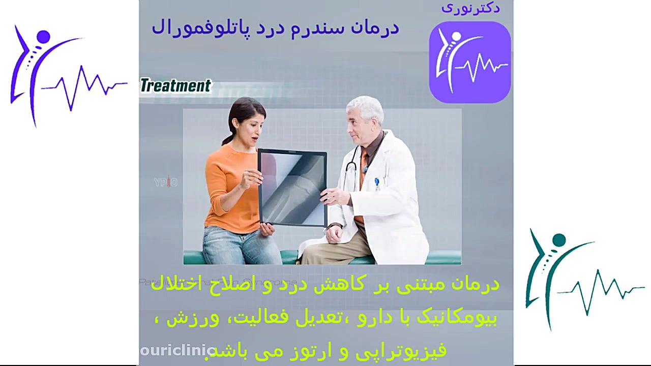 درمان سندرم درد پاتلوفمورال دکتراسماعیل نوری