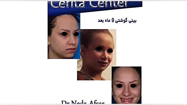 دکتر علی بخشنده فرد متخصص جراحی فک و صورت Blood Gas