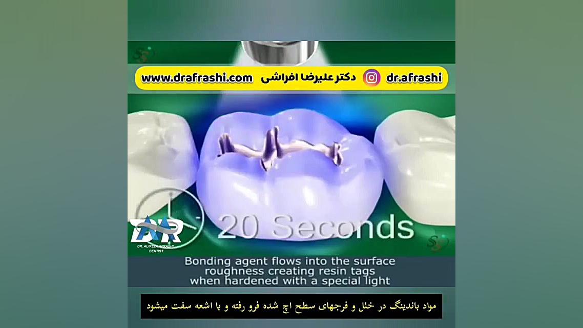 ترمیم دندان (پر کردن دندان) scATAC-Seq