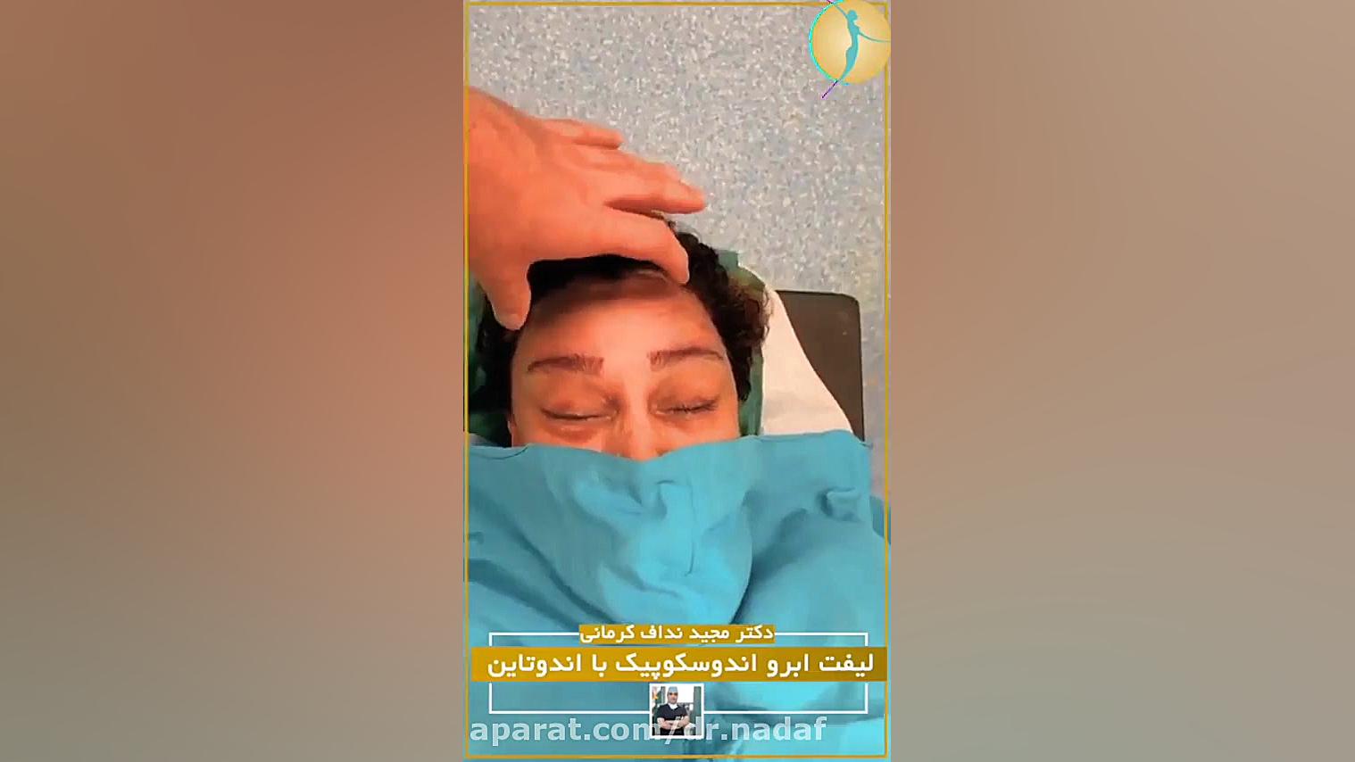 فیلم جراحی بالا کشیدن ابرو بیانسه