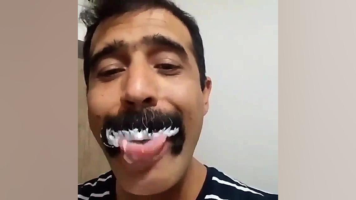اگه دچار بی اشتهایی هستین و میل به غذا ندارین این ویدئو رو ببینید تزریق چربی