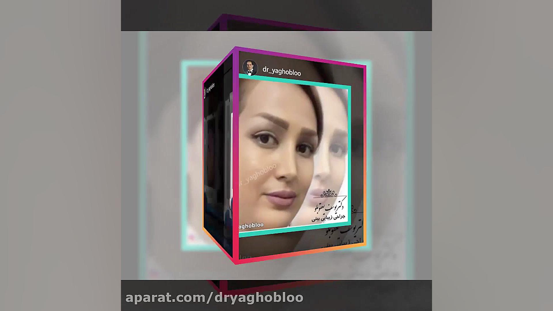 معرفی اینستاگرام دکتر یوسف یعقوبلو زمان34ثانیه
