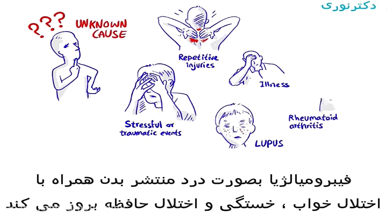 فیبرومیالژیا دکتراسماعیل نوری