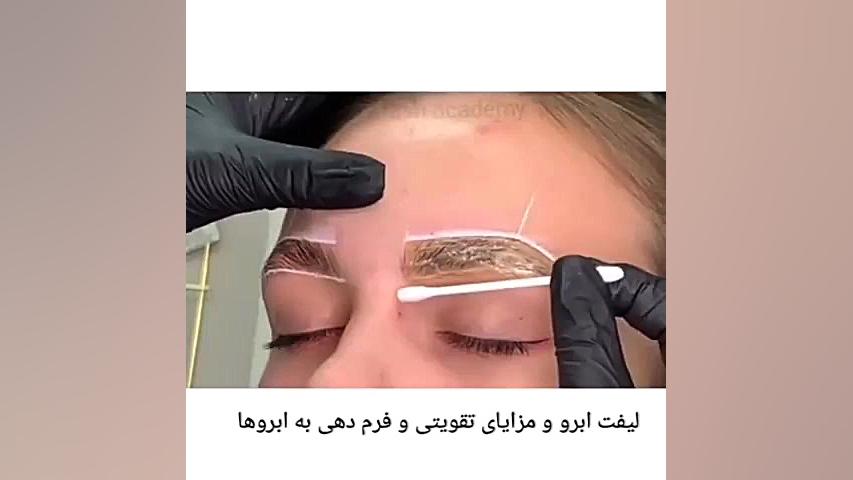 تفاوت لمینت ابرو و لیفت ابرو scATAC-Seq