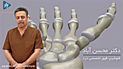 سندرم مچ دستی یا تونل کارپال چ...