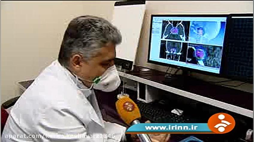 انجام به روز ترین درمان های رادیوتراپی دنیا در ایران 1 استفان کری