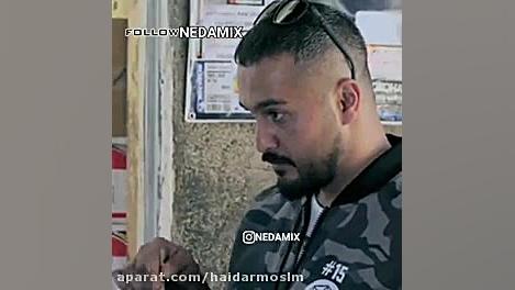 تیکه دار درمان ریزش مو
