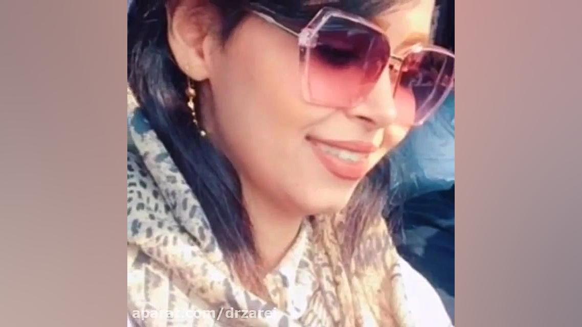 جراحی بینی عروسکی اتوپلاستی