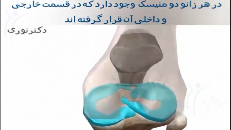 منیسک زانو دکتراسماعیل نوری