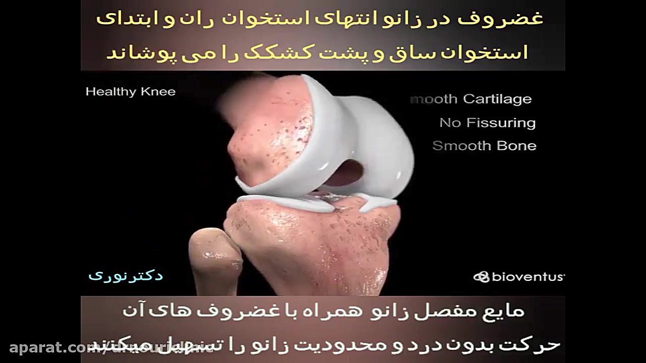غضروف زانو دکتراسماعیل نوری