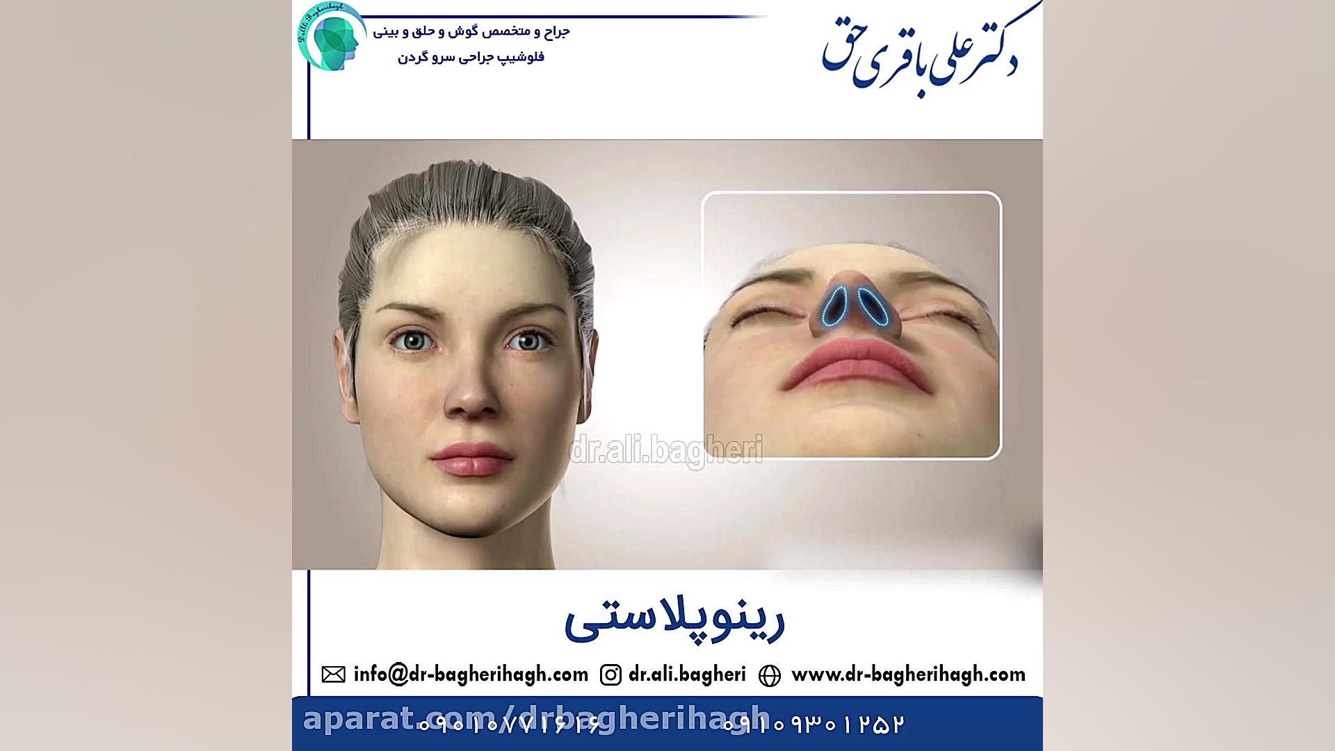 رینوپلاستی دکتر علی باقری حق