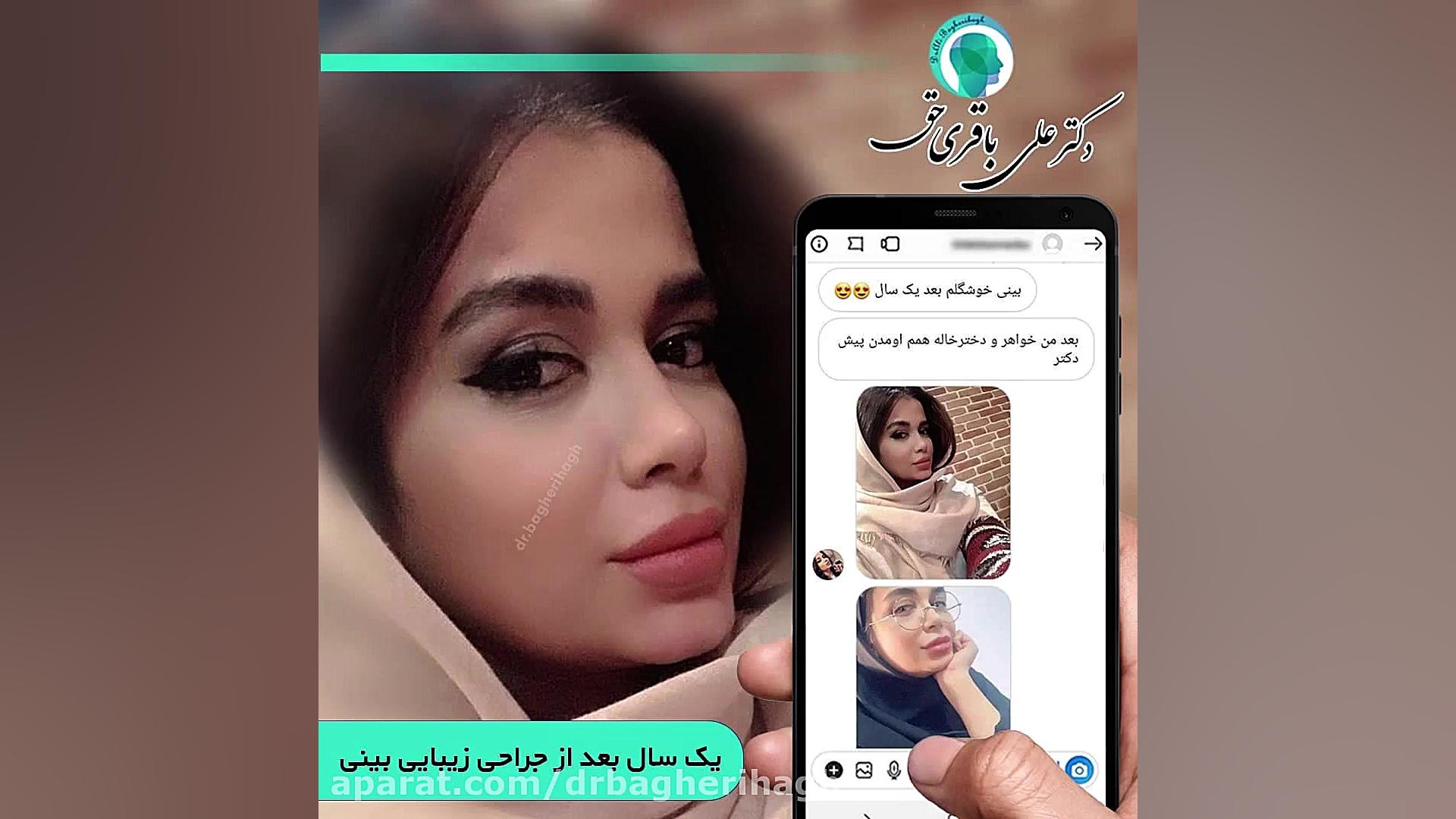 نمونه کارهای جراحی بینی | جراح بینی دکتر علی باقری حق