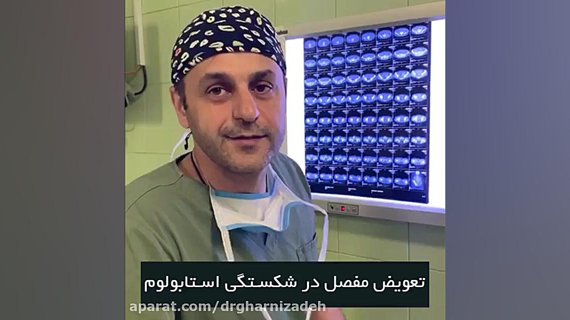 تعویض مفصل در شکستگی استابولوم برداشتن زگیل