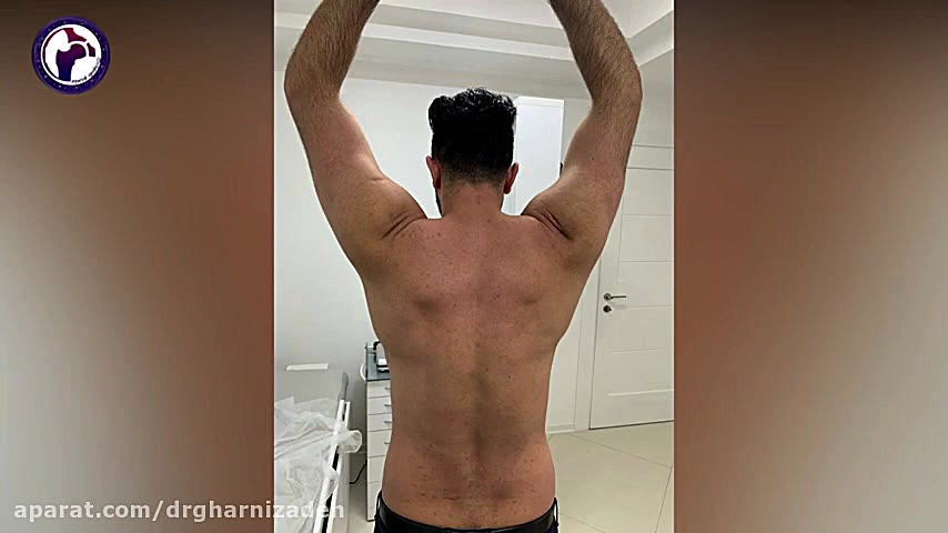 جراحی شکستگی دررفتگی شانه کیم کارداشیان