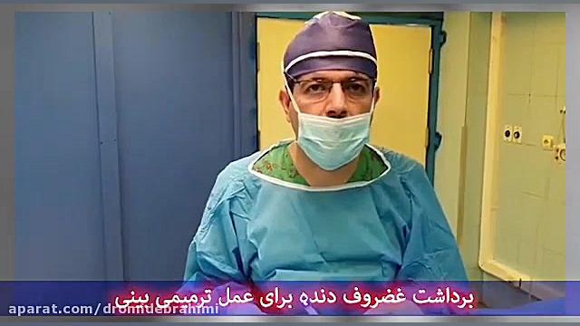 برداشت غضروف دنده برای عمل ترمیم بینی توسط دکتر امید ابراهیمی بهترین جراح بینی دکتر امید ابراهیمی