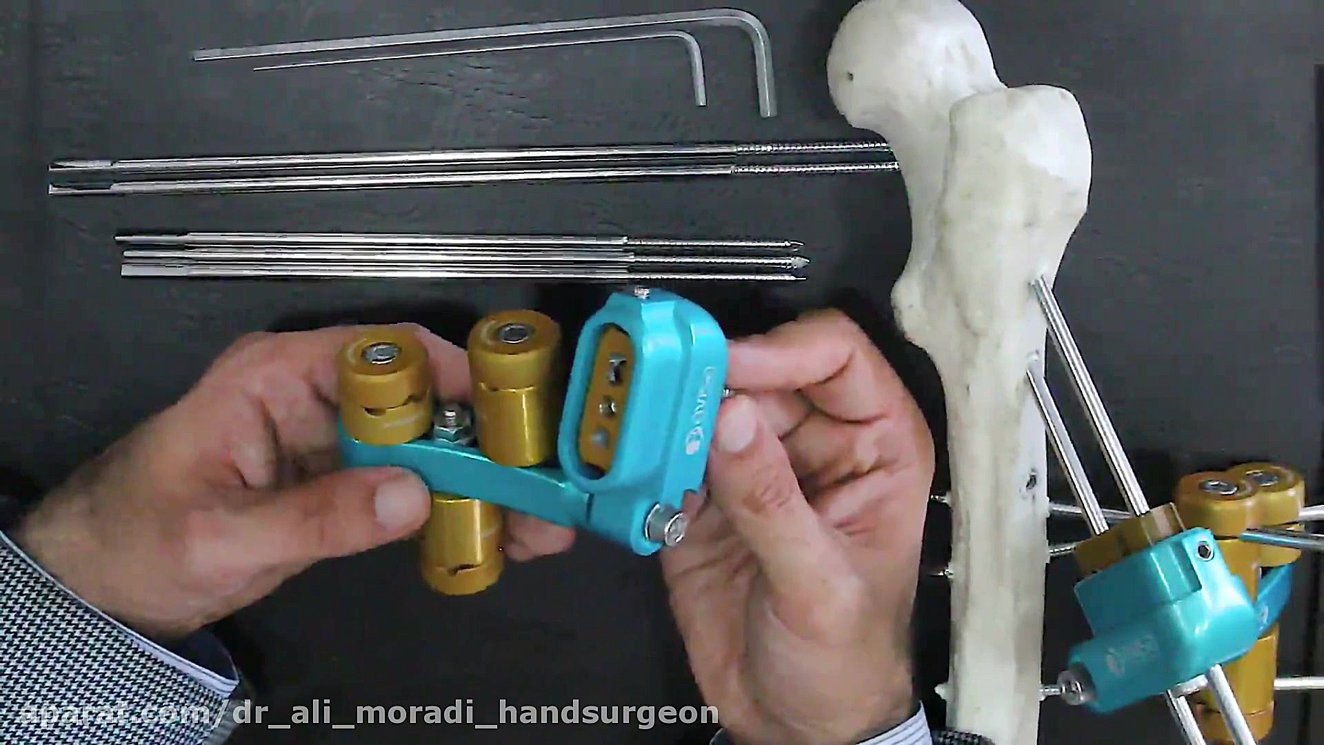 اکسترنال فیکساتور دینامیک هیپ Dynamic Hip External Fixator دکتر علی مرادی جراح دست