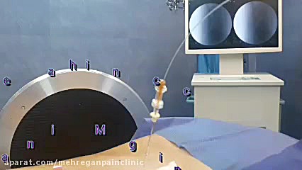 درمان دیسک کمر با لیزر. کلینیک درد مهرگان منافذ باز پوست