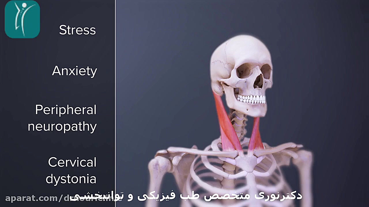 اسپاسم و گرفتگی گردن هوش مصنوعی ترند