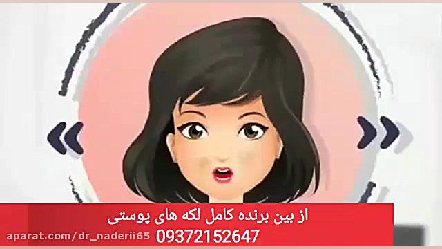 داشتن پوستی جوان و شاداب برای همیشه(کرم ضدلک لازان از بین برنده لکه های پوستی) آکنه
