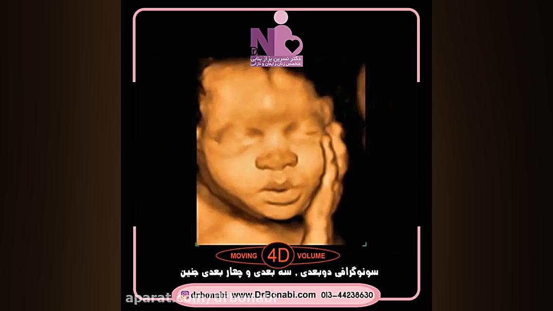 انواع #سونوگرافی_جنین کامنت