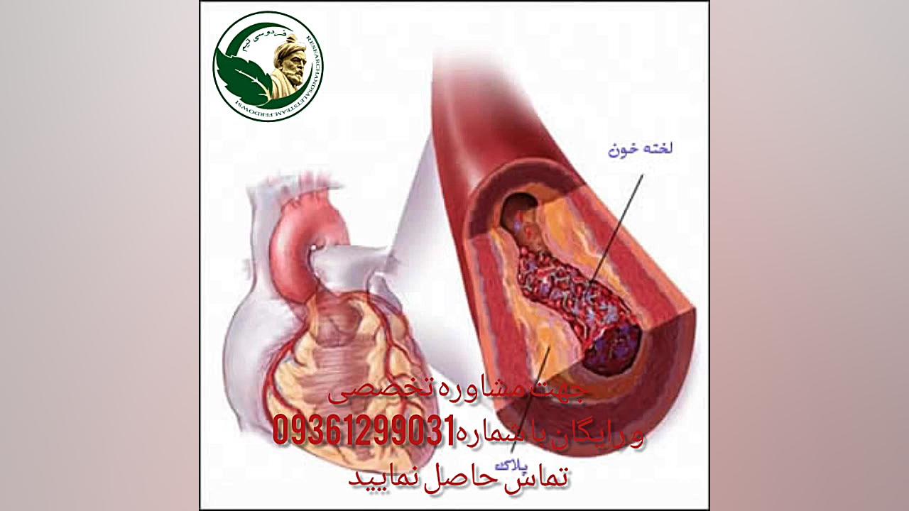 درمان بیماری های قلبی و عروقی با روش های سنتی اینسایزینگ