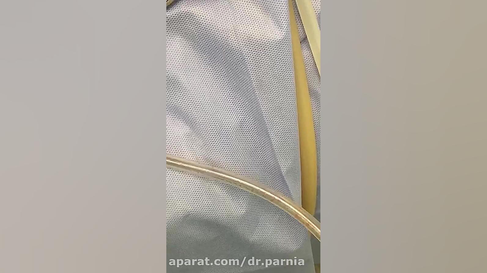 فیلم بدون سانسور لیپوماتیک شکم و پهلو به همراه ابدومینوپلاستی دکتر رفیع پرنیا فوق تخصص پلاستیک