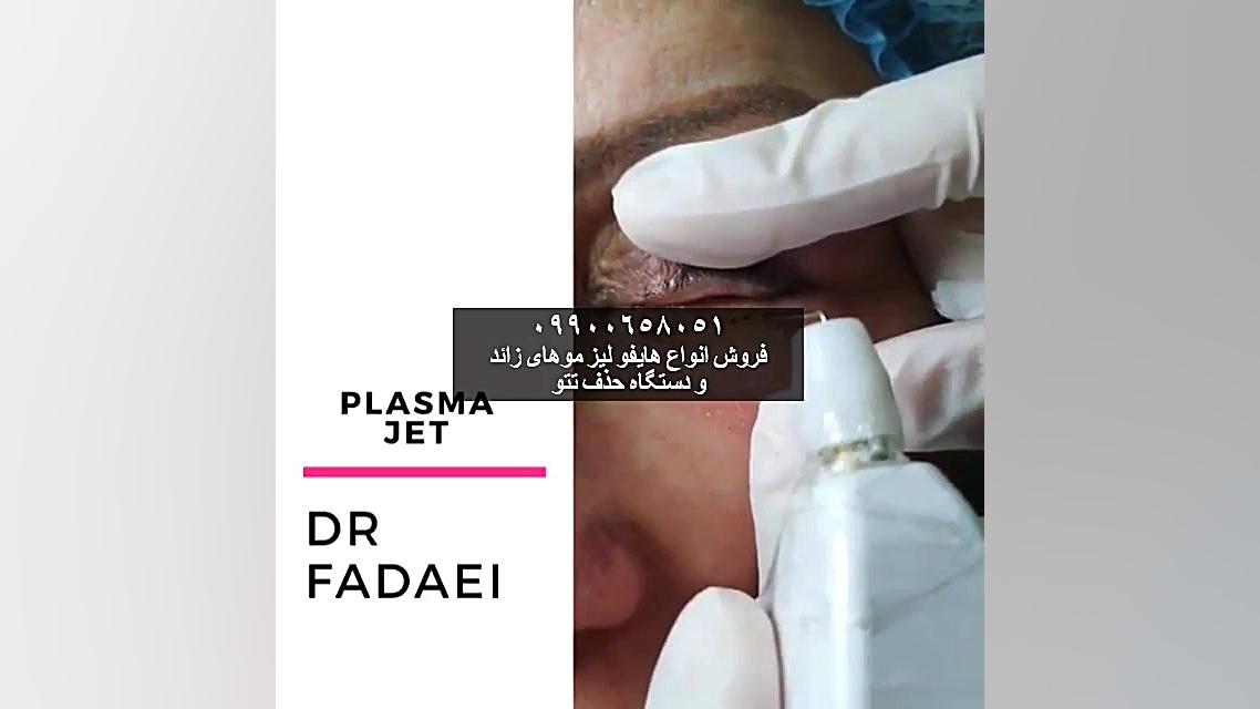 ✔ با پلاسماجت رد زمان را از چهره تان پاک کنید !_________________ جراحی گوش